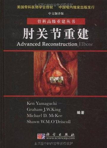 肘关节重建