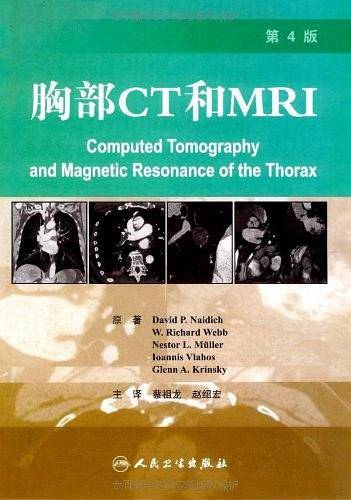 胸部CT和MRI