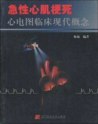 急性心肌梗死心电图临床现代概念