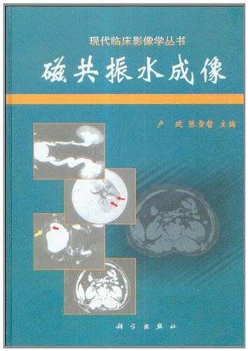 磁共振水成像