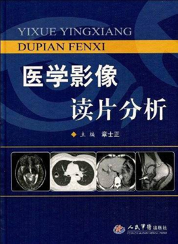 医学影像读片分析