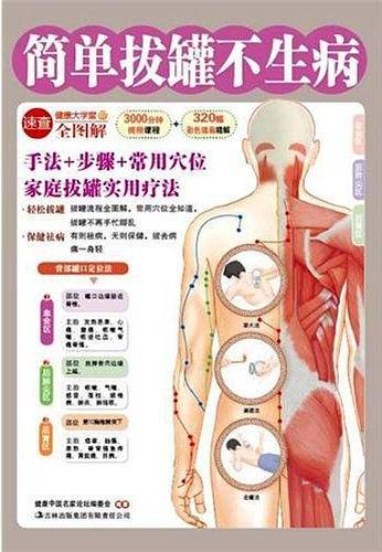 简单拔罐不生病
