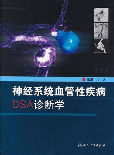神经系统血管性疾病DSA诊断学