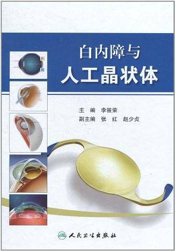 白内障与人工晶状体