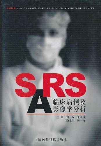 SARS临床病例与影像学分析