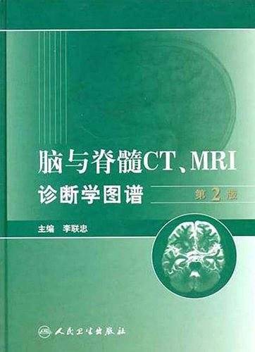 脑与脊髓CT MRI诊断学图谱