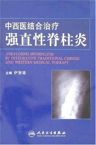 中西医结合治疗强直性脊柱炎