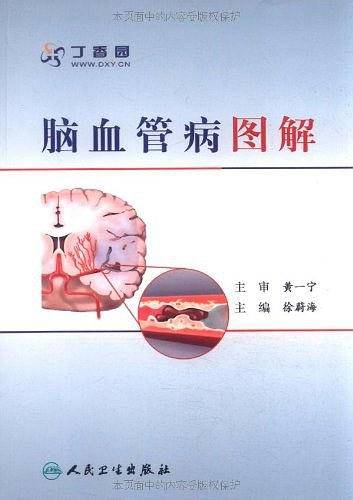 脑血管病图解
