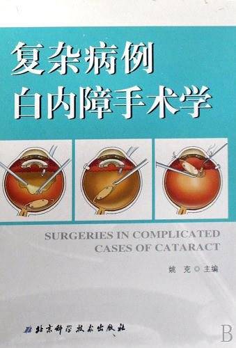 复杂病例白内障手术学