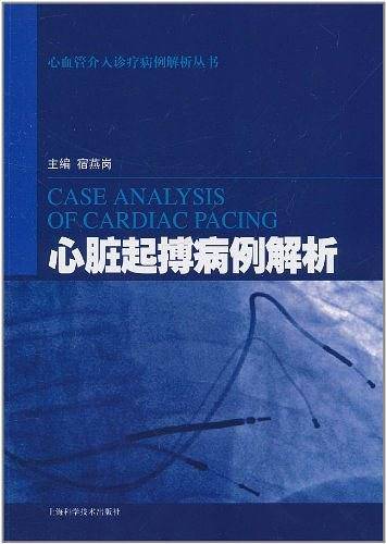 心脏起搏病例解析