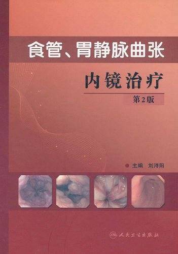 食管、胃静脉曲张内镜治疗