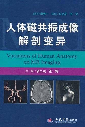 人体磁共振成像解剖变异