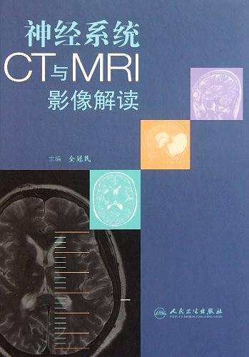 神经系统CT与MRI影像解读