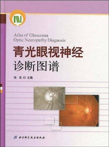 青光眼视神经诊断图谱