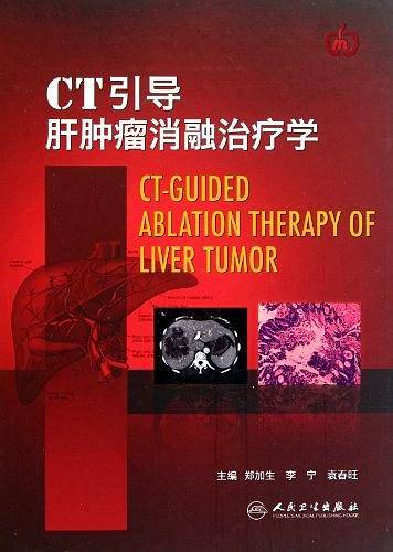 CT引导肝肿瘤消融治疗学