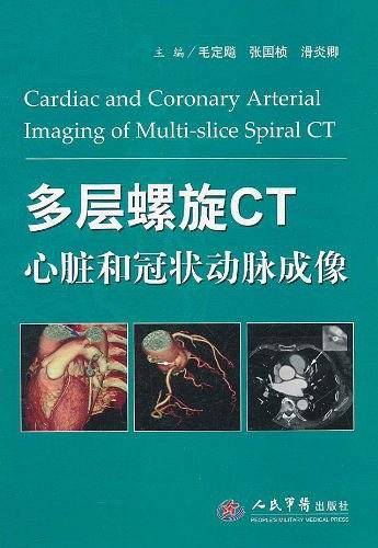 多层螺旋CT心脏和冠状动脉成像