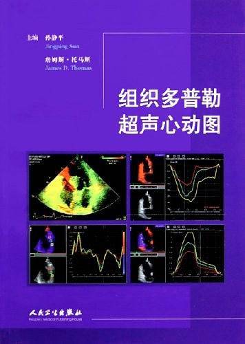 组织多普勒超声心动图