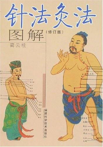 针法灸法图解