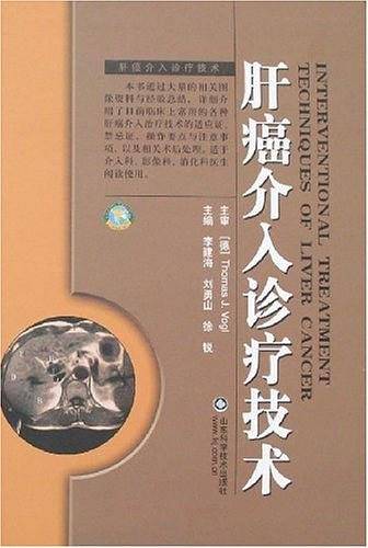 肝癌介入诊疗技术