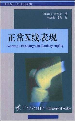 正常X线表现