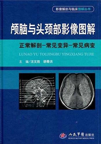颅脑与头颈部影像图解.影像解剖与临床图解丛书