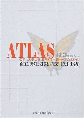 红斑狼疮图谱