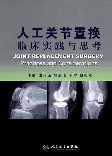 人工关节置换临床实践与思考