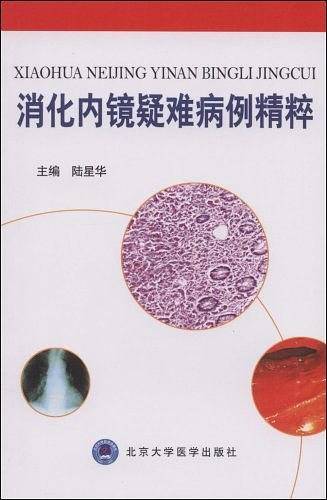 消化内镜疑难病例精粹