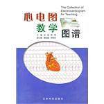 心电图教学图谱