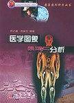医学图象处理与分析——图象图形科学丛书