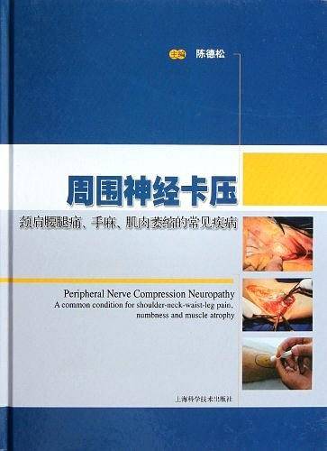 周围神经卡压
